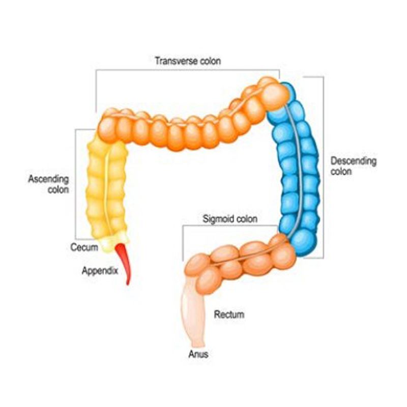 Symptoms of Colon Cancer